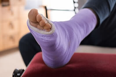 Broken Foot Treatment, Foot and ankle fractures treatment in the Midtown Manhattan, New York, NY 10036 area